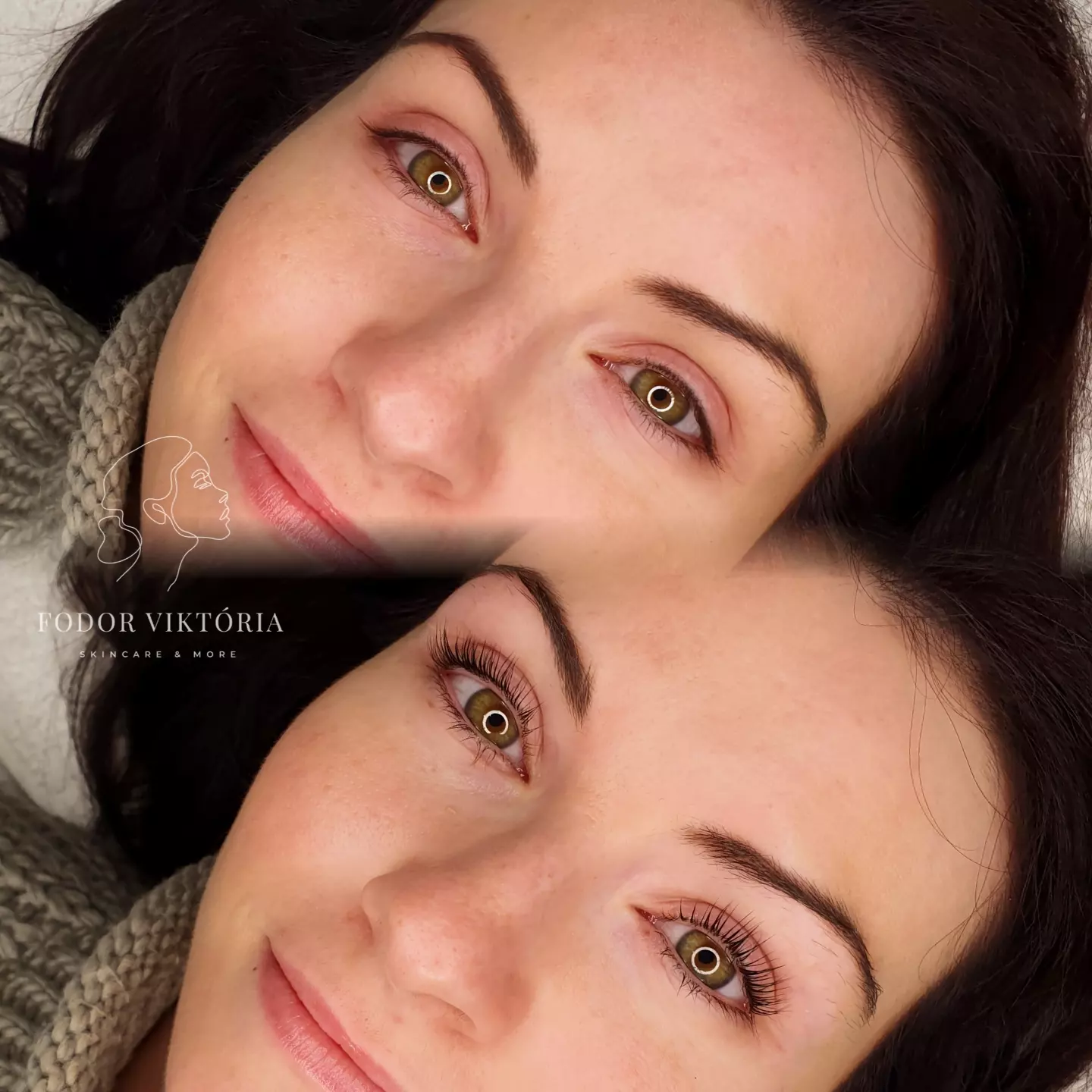 szalas-tetovalas utan