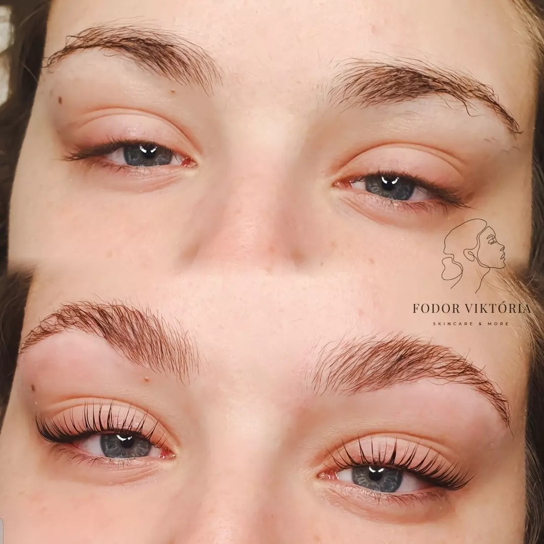 szalas-tetovalas elott